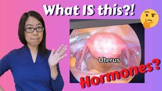 Everything HYSTERECTOMY - Gynecologist answers all your questions!