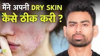 त्वचा का रूखापन - Dry Skin Permanent Solution | Fit Tuber Hindi