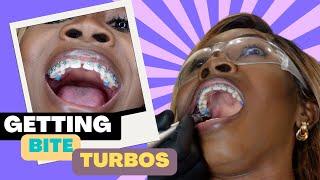 I Broke A Bracket | Getting Bite Turbos | #adultbraces | Just Wideline