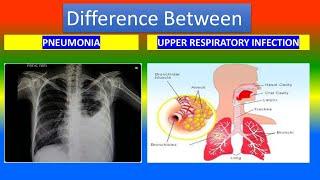 PNEUMONIA Vs. UPPER RESPIRATORY INFECTION