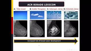 Dr.rasha  mohammed kamal update in mammography