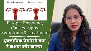 Ectopic Pregnancy   Causes, Signs, Symptoms & Treatment   एक्टोपिक प्रेगनेंसी क्या है लक्षण और कारण