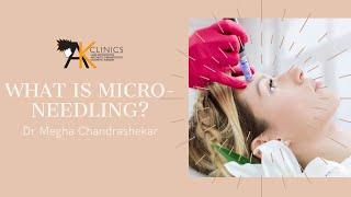 What is Micro-needling | All about and how it helps? (AK Clinics)