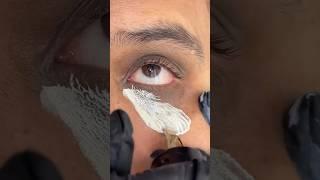 DIY Magical Dark Circles Removal Cream, 3 Days remove Eye wrinkles #darkcircles #beauty #skincare