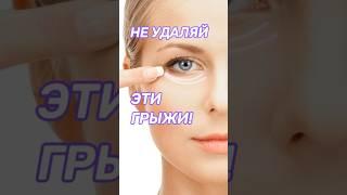 Как убрать мешки под глазами?