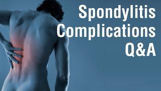 Troubleshooting Spondylitis Information Session