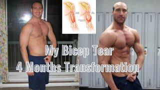 Bicep Tear Recovery: How I Got Back In Top Shape After 4 Months