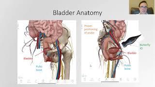 How to Complete a Bladder Scan with the Butterfly iQ