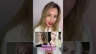 Что сделала со своим лицом модель Алена Шишкова?!