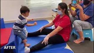 Physical Therapy for Children | Conditions & Improvements Before & After Therapy