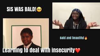 STORYTIME: I was BALD! || Dealing with insecurity and negativity.