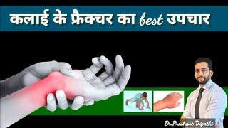 WRIST FRACTURE | WRIST INJURY |WHAT TO DO IN WRIST FRACTURE