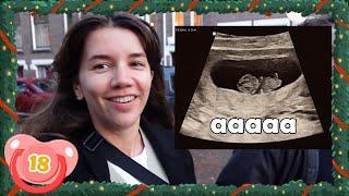 De baby zwaait naar ons & 10 weken zwangerZWANGERSCHAPSVLOG 18