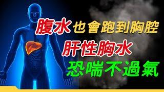 腹水也會跑到胸腔 肝性胸水恐喘不過氣｜好心肝·好健康