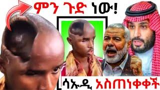 የማይታመን! ጭንቅላቱ ባዶ የሆነው ሰውዬ ድንቅ ተዓምር |ሳኡዲ ዝምታዋን ሰበረች|Minber tv|የኔ መንገድ|ነጃህ ሚዲያ|ebs tv|welo tube|donkey