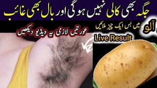 Permanent hair removal at home | Best Hair Removal Cream | Painless hair removal | DIY Remedies