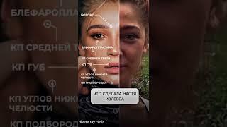 "Секреты красоты Насти Ивлеевой: все косметологические процедуры звезды!"