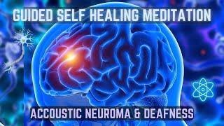 Sound Healing: Visualize Relief - Acoustic Neuroma and Enhance Hearing #deaf #hearingloss #deafness