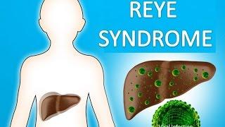 Reye Syndrome