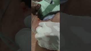 FNAB fine needle aspiration biopsy by denisoeroso (1)