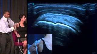 Dr. Don Buford Live 13 Point Shoulder Ultrasound Exam Demo