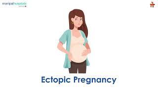 What is Ectopic Pregnancy? l Manipal Hospitals Bengaluru