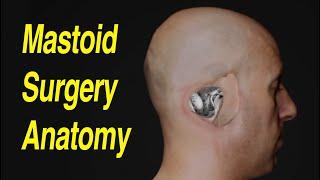 Mastoidectomy Anatomy