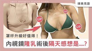 罩杯升級好值得！內視鏡隆乳「術後隔天」感想是……｜#台北隆乳 #楊善淳醫師 #璞美