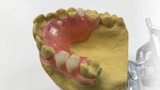 How To Make A Fiber Flex™ Partial - The Entire Process | Dental Lab Learning