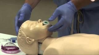 Airway Management