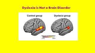 Dyslexia: Some Background Information, Andrew P. Johnson, Ph.D.