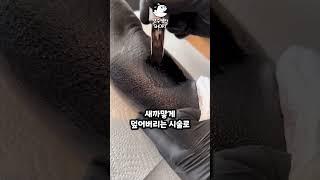 팔전체가 새까만 이유