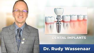 Options for Denture Wearers with Williams Lake, BC dentist Dr. Rudy Wassenaar