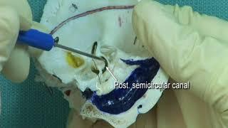 1.7 Step 6. Position and orientation of the semicircular canals