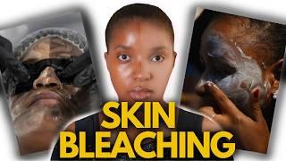 Skin Bleaching and Colorism