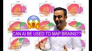 AI for Brain Maps