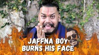 Jaffna boy burns his face