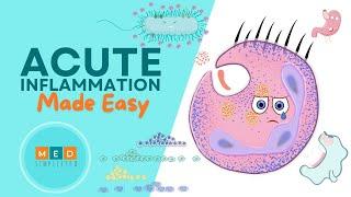 Acute Inflammation Made Easy