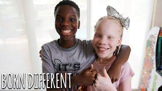 My Twin Sister Has Albinism | BORN DIFFERENT