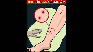 अगर सांप काट ले तो क्या करे | What to do if a snake bites ?