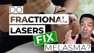 Should you use Fractional Lasers? | Dr Davin Lim