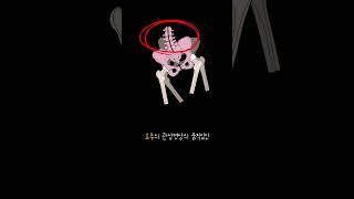 (운동의 기준) 고관절 파헤치기 5탄: 관상면상에서의 고관절의 움직임과 골반 불균형