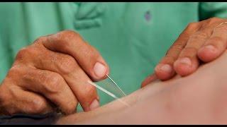 NYC Acupuncture  | Dr. Steven Schram | Call 212-696-4426