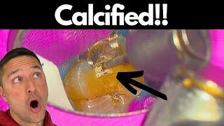 They don’t teach THIS tip in SCHOOL.  (Simplified Calcified Max Molar Technique)