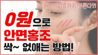 안면 홍조 없애고 싶다면 '이것' 필수! 돈 쓰지 말고 집에서 해결하세요!｜안면홍조원인｜안면홍조없애는법｜안면홍조에좋은음식