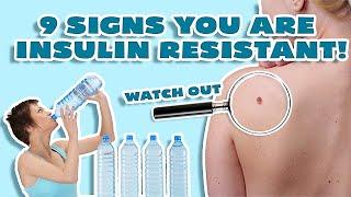 Insulin Resistance Symptoms (WHY YOU CAN'T LOSE WEIGHT!)