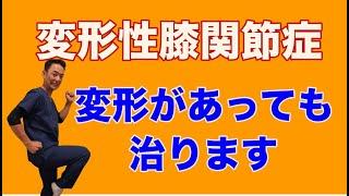 変形性膝関節症は変形があっても治ります