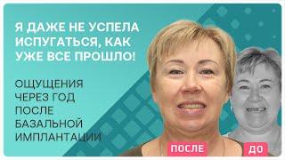 Имплантация верхней челюсти – отзыв пациента после базальной имплантации зубов