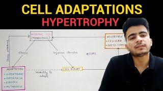 Hypertrophy | Cell Adaptations (1/3) | General Pathology | EOMS