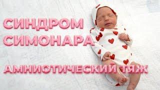 НАША ИСТОРИЯ! Я СМОГЛА И ТЫ СМОЖЕШЬ! Амниотический тяж или синдром Симонара